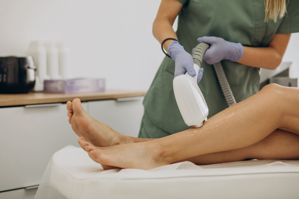 benen ontharen laser prijs